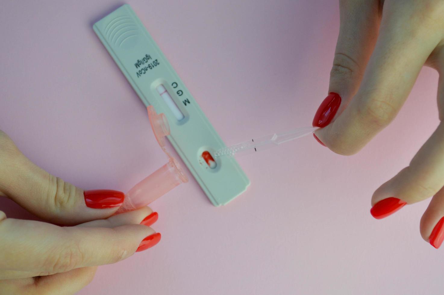 Rapid COVID-19 antibody test for IgM and IgG antibodies to novel coronavirus SARS-CoV-2, Covid-19 viral pneumonia. Medics hand in glove holds the test photo