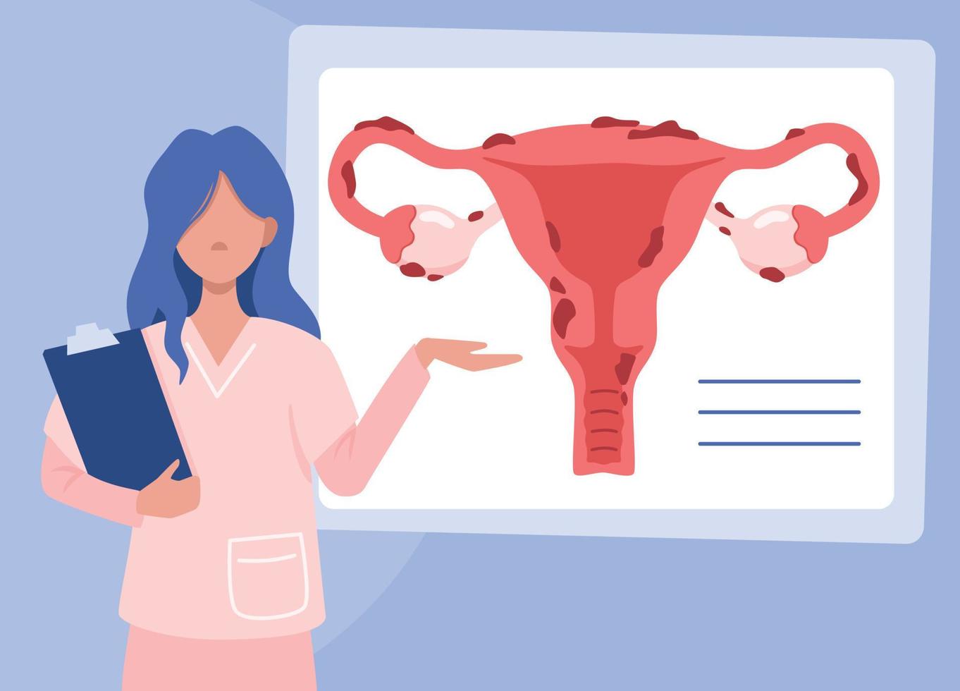 ilustración del útero y la endometriosis. médico explica los resultados de un examen ginecológico. enfermedades de la mujer y prevención de la salud de la mujer vector