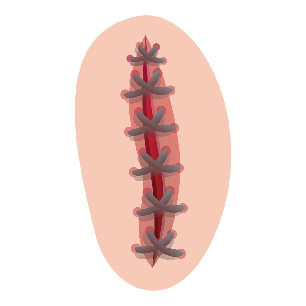 icono de sutura de bisturí, estilo de dibujos animados vector