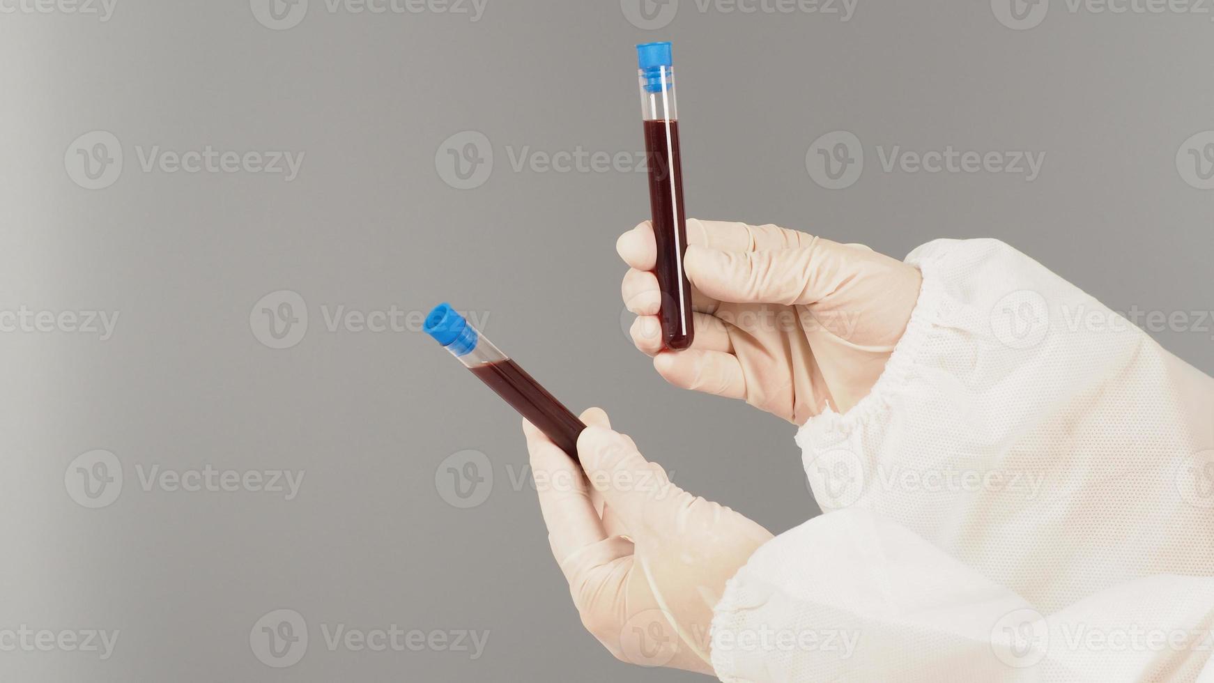 Hands are holding two blood test tubes on grey background. Hand wears a PPE suit and a white medical glove. photo
