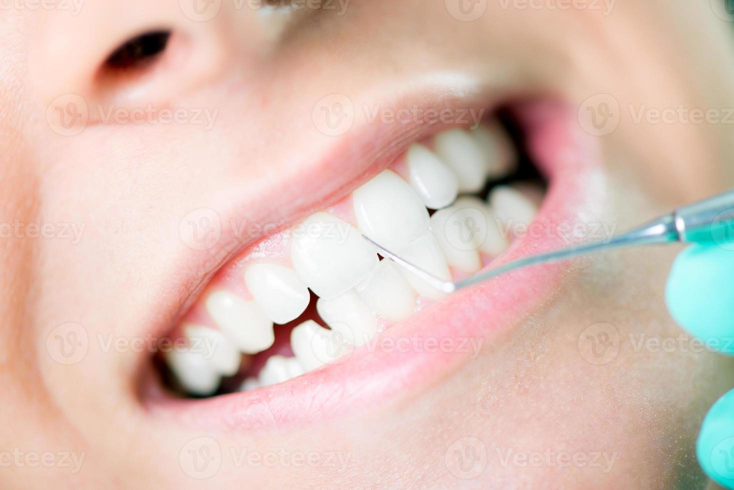vista limpieza dental foto