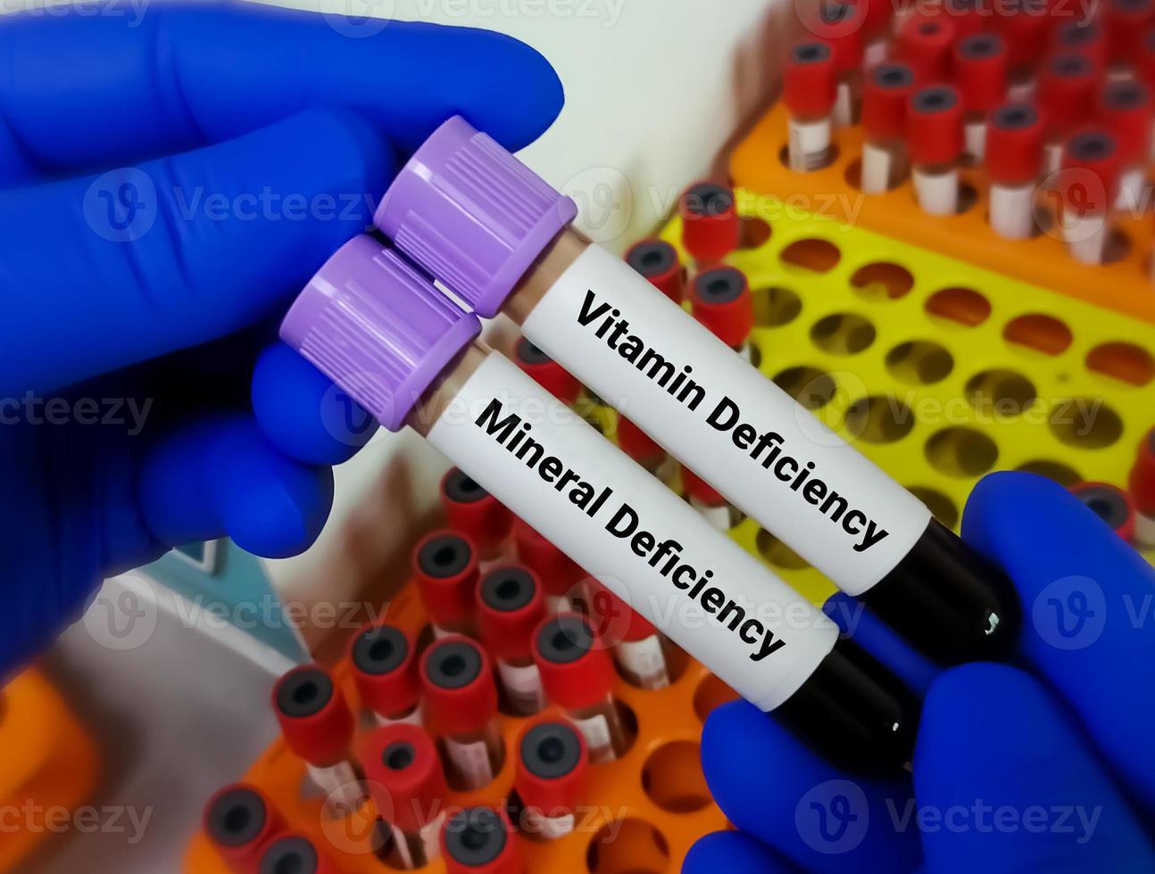 Scientist hold two blood sample one is order for Vitamin deficiency  test another is Mineral deficiency test with laboratory background. photo