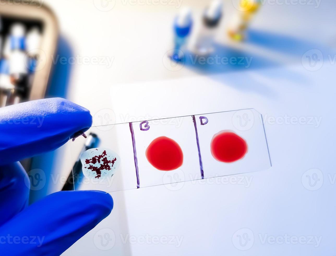 A Negative blood type, one of the rare blood group in worldwide. Blood group and Rh factor testing by slide agglutination method. photo