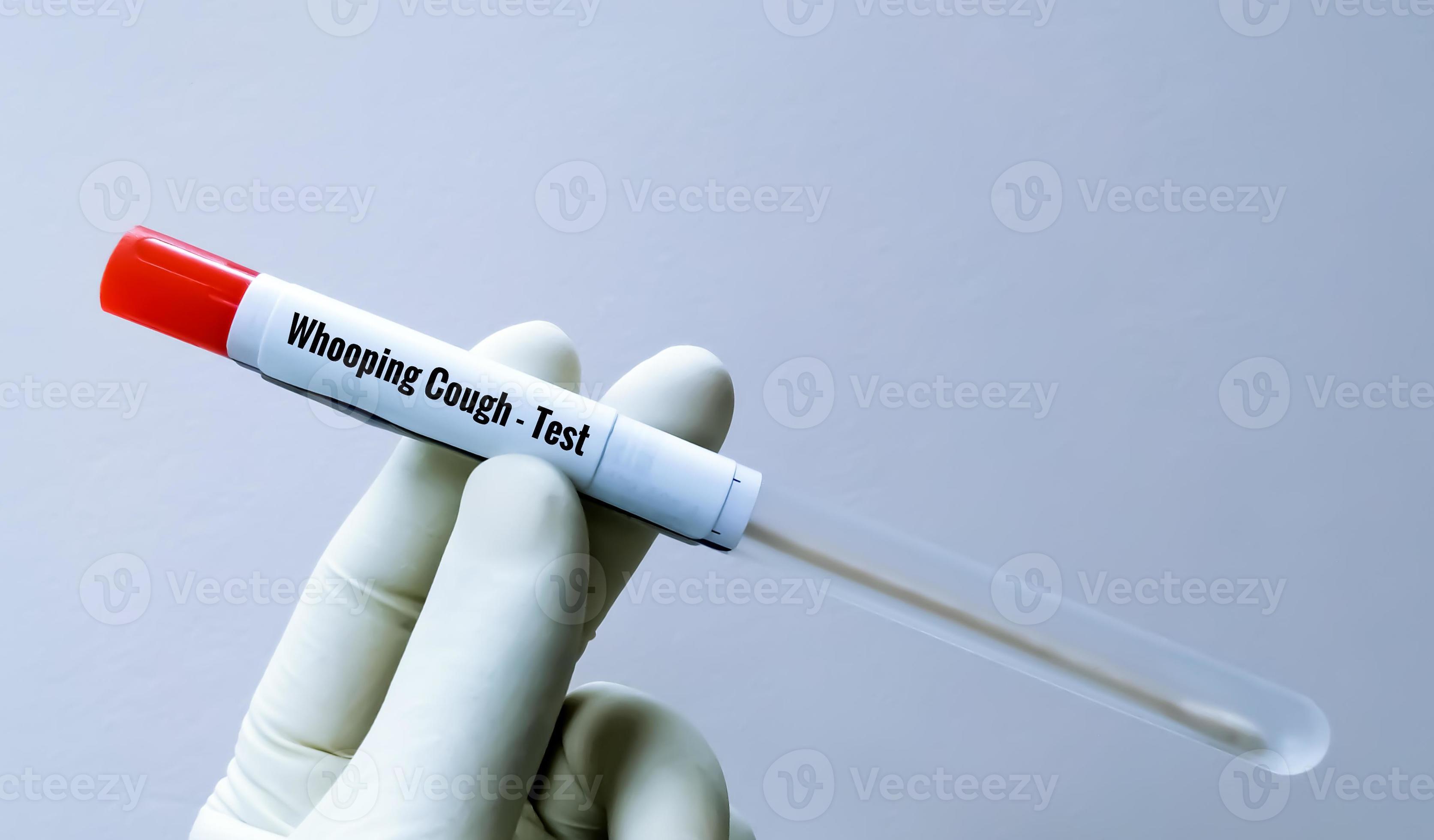 scientist-holding-swab-sample-for-whooping-cough-test-a-disease-by