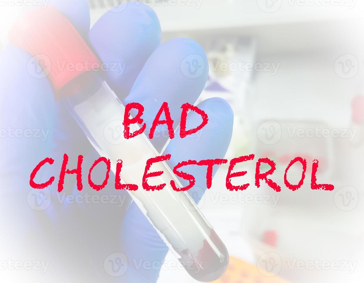 Bad Cholesterol term with laboratory background. medical conceptual image. photo