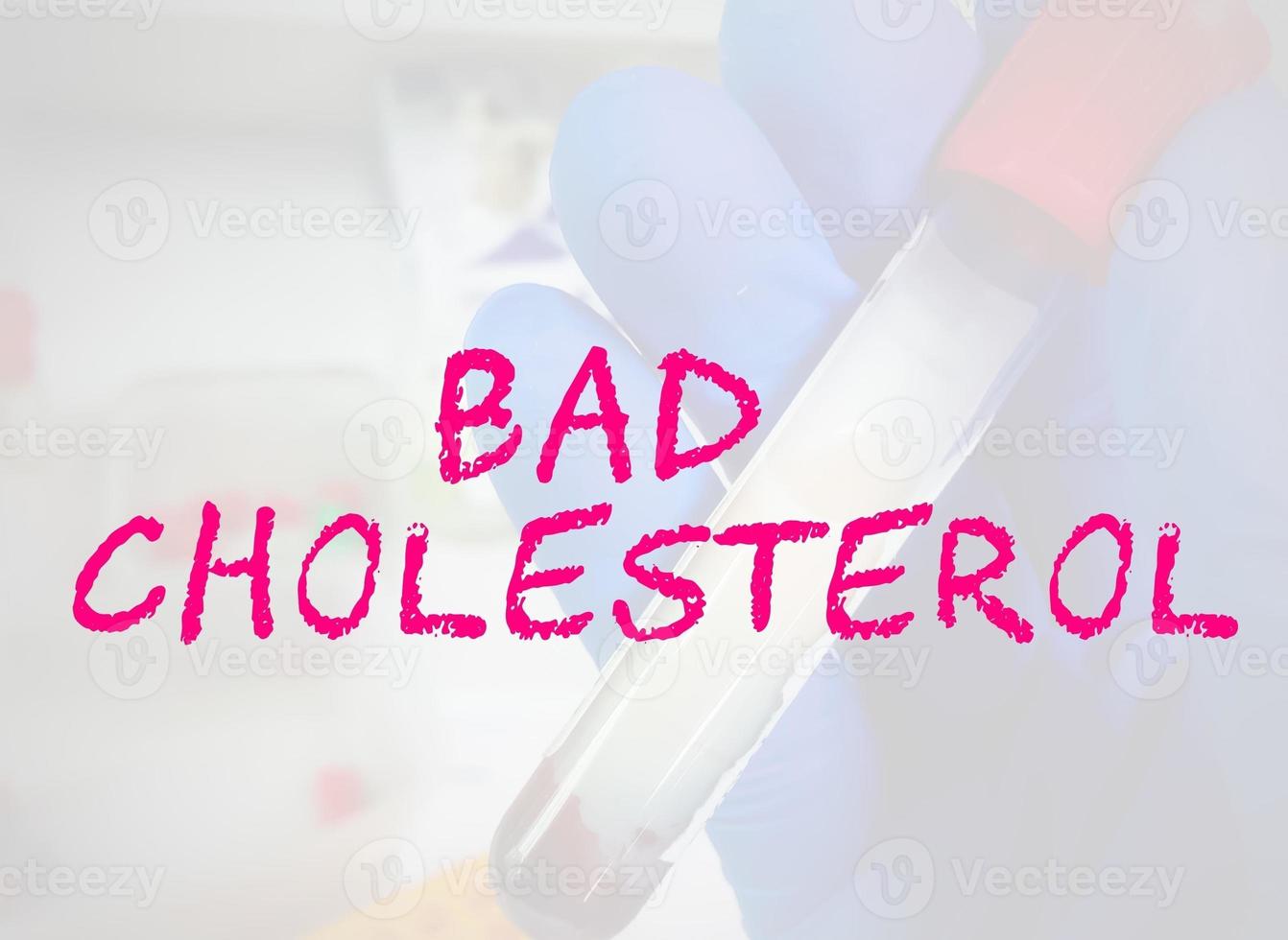 término de colesterol malo con antecedentes de laboratorio. imagen conceptual médica. foto