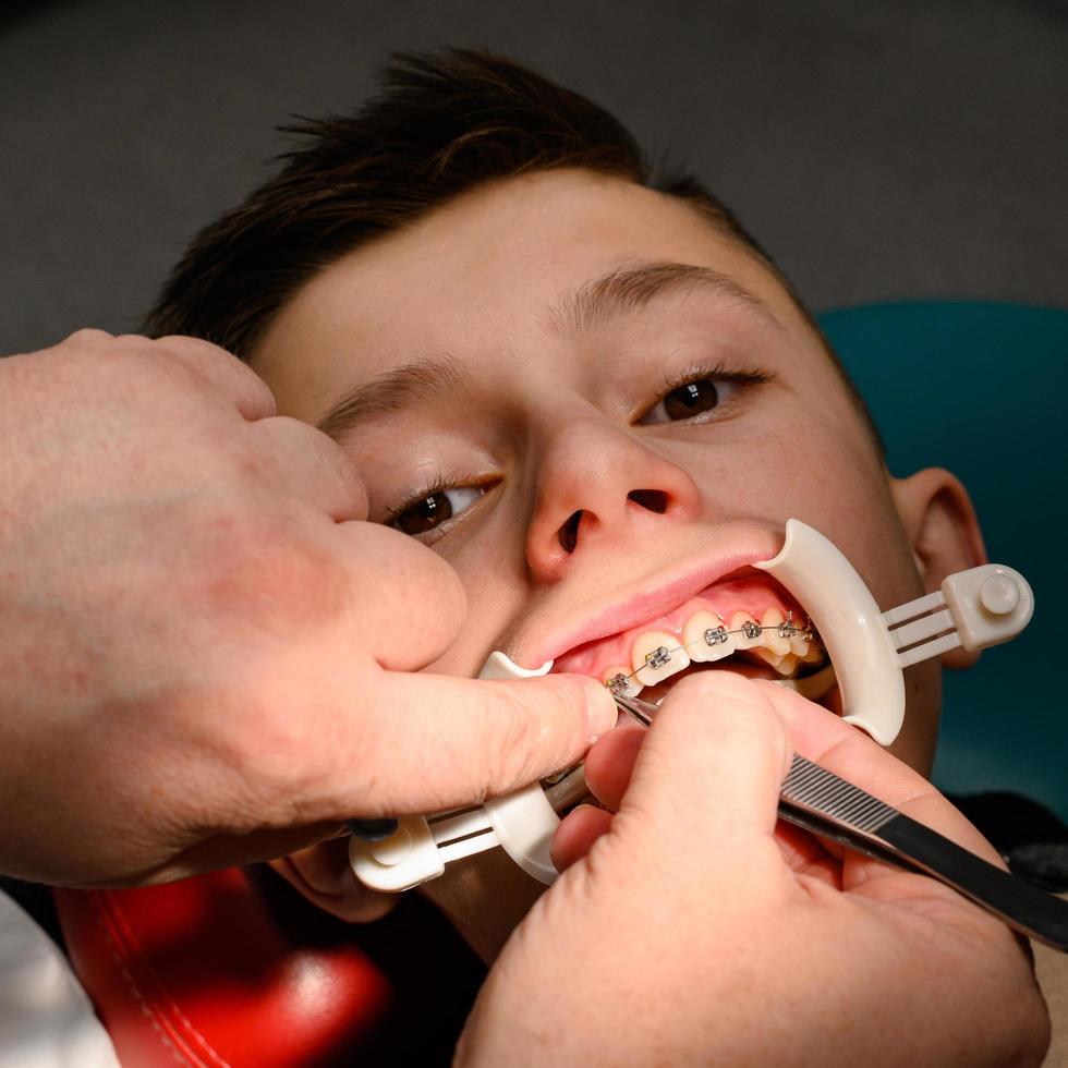 An orthodontist glues and fastens braces on the upper teeth of a schoolboy, aligning teeth with braces. photo