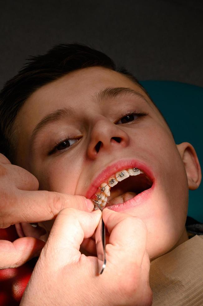 An orthodontist glues and fastens braces on the upper teeth of a schoolboy, aligning teeth with braces. photo