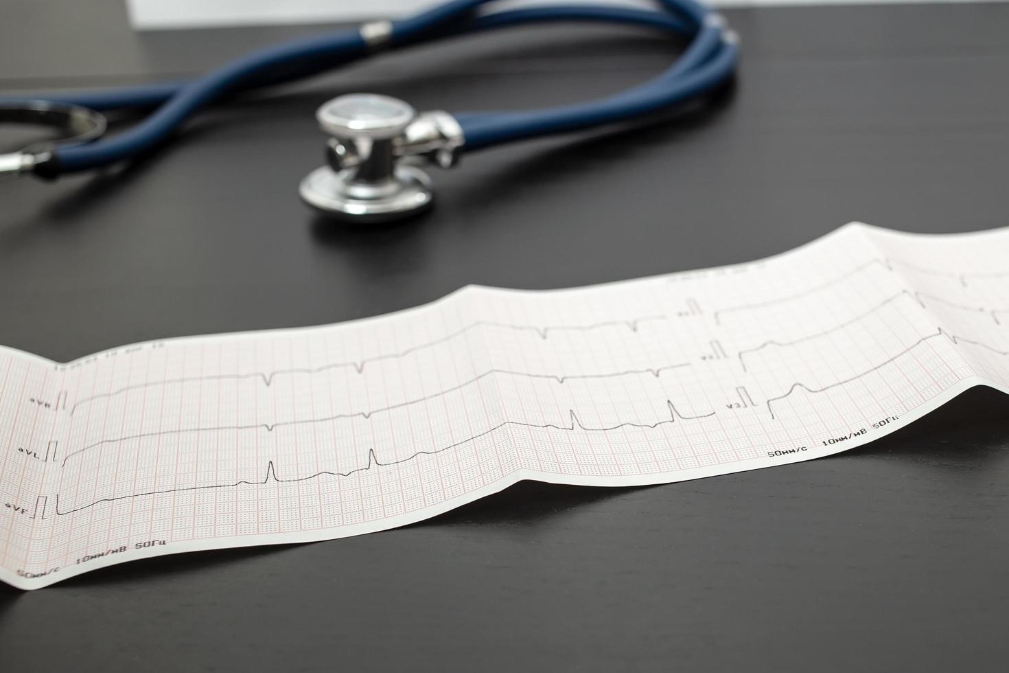 Cardiogram and a stethoscope are on the black table. Health concept. photo