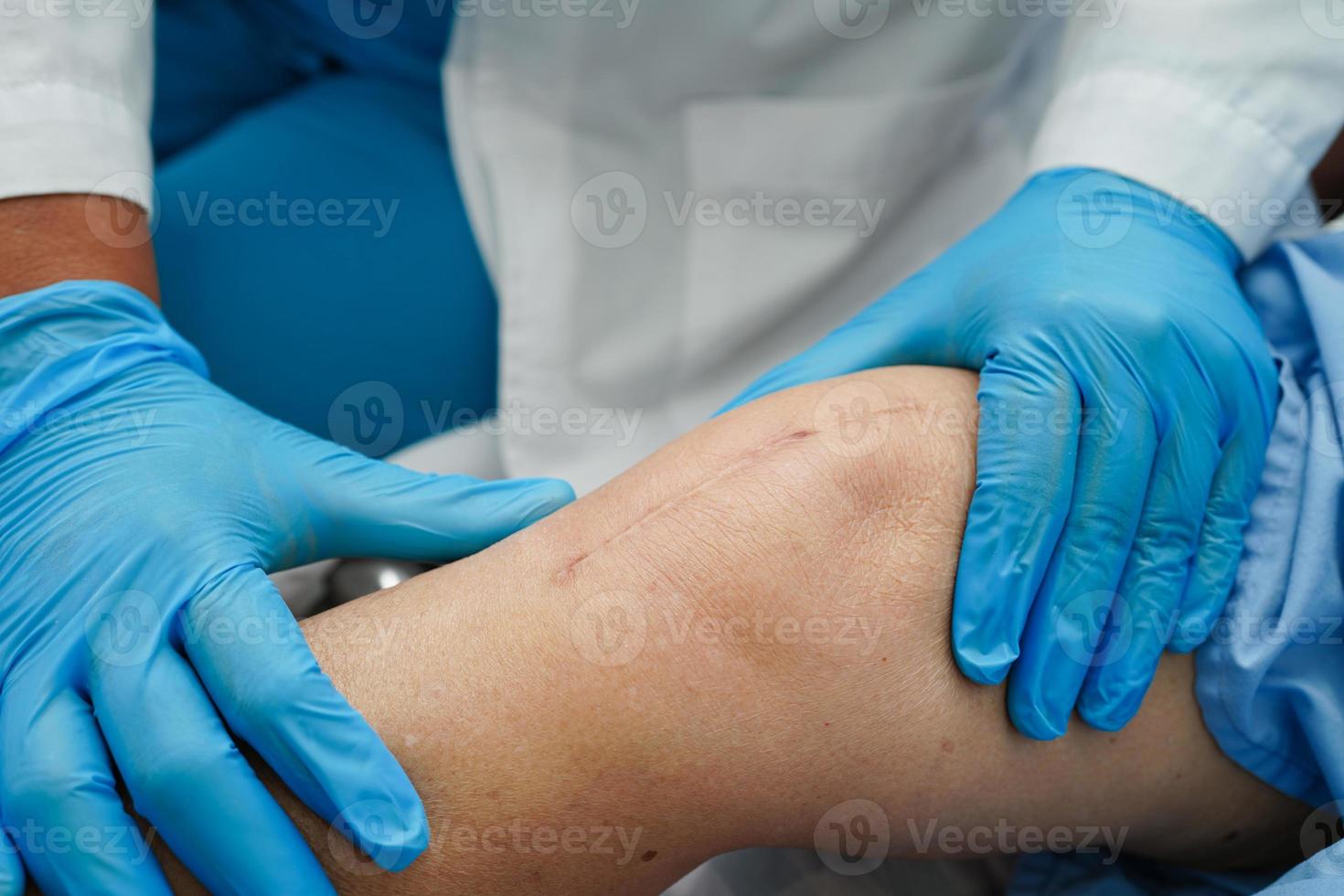 Doctor checking Asian elderly woman patient with scar knee replacement surgery in hospital. photo