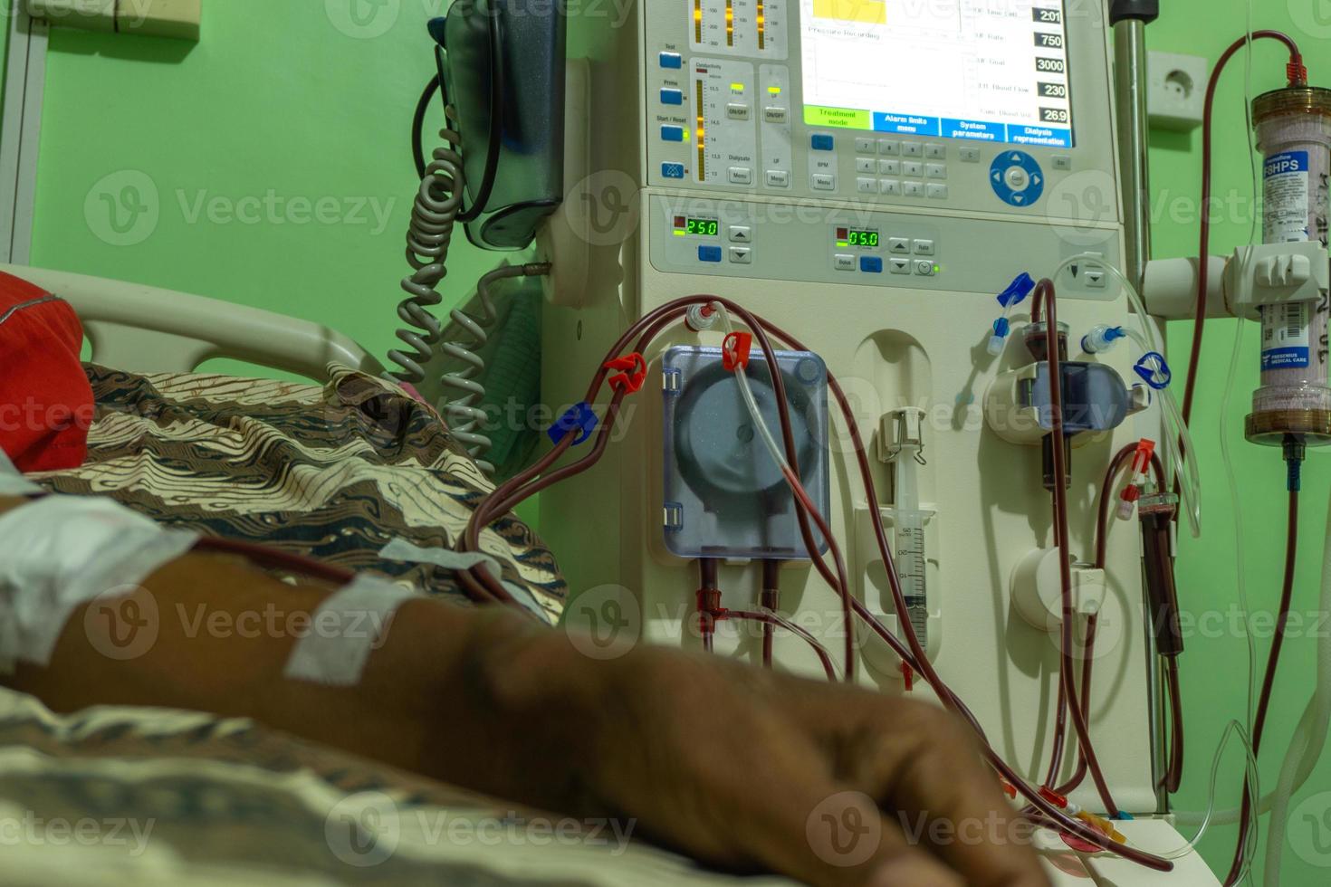 máquina de diálisis. sistema de diálisis. hemodiálisis en pacientes en el hospital. foto