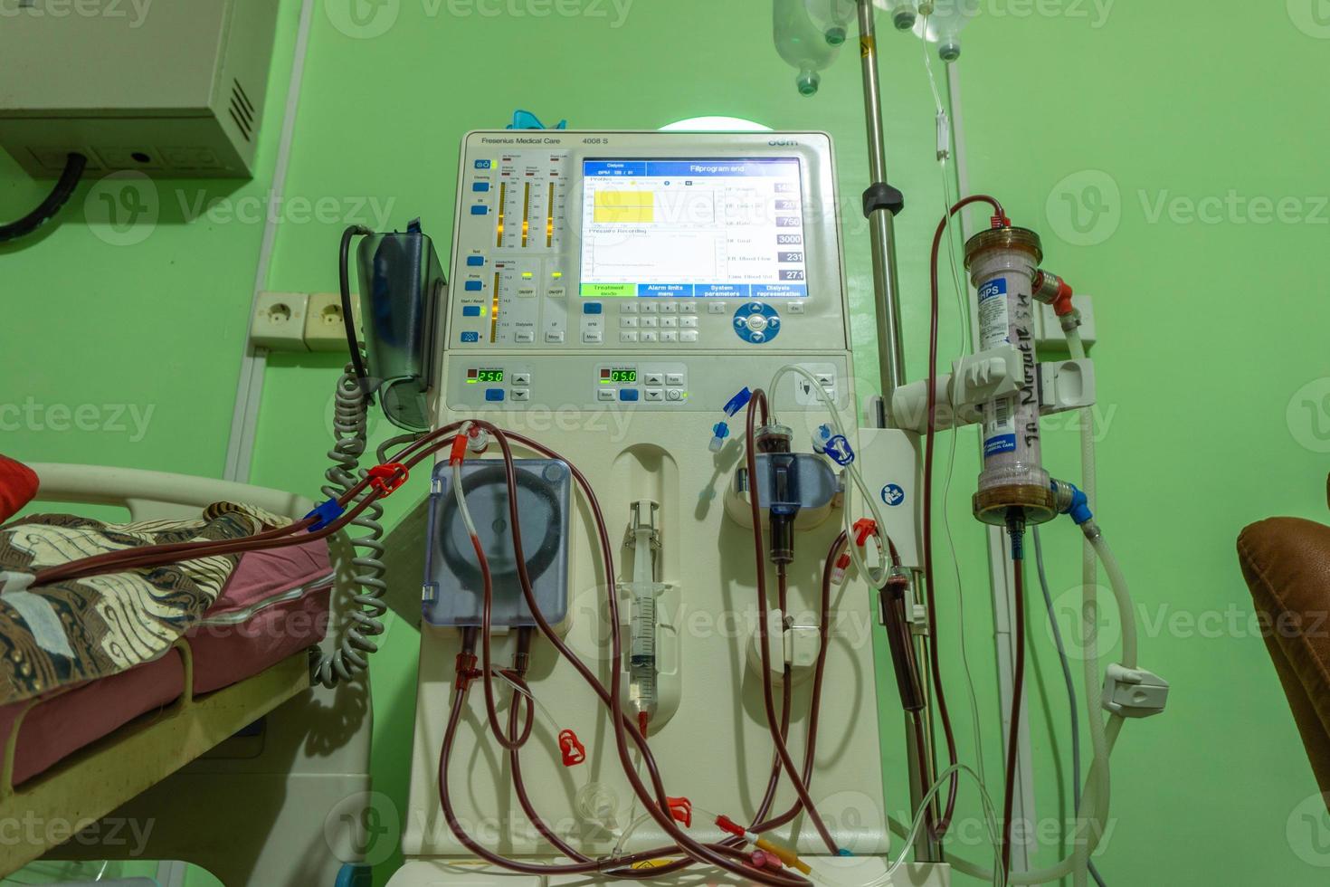Dialysis machine. dialysis system. hemodialysis in patient at hospital