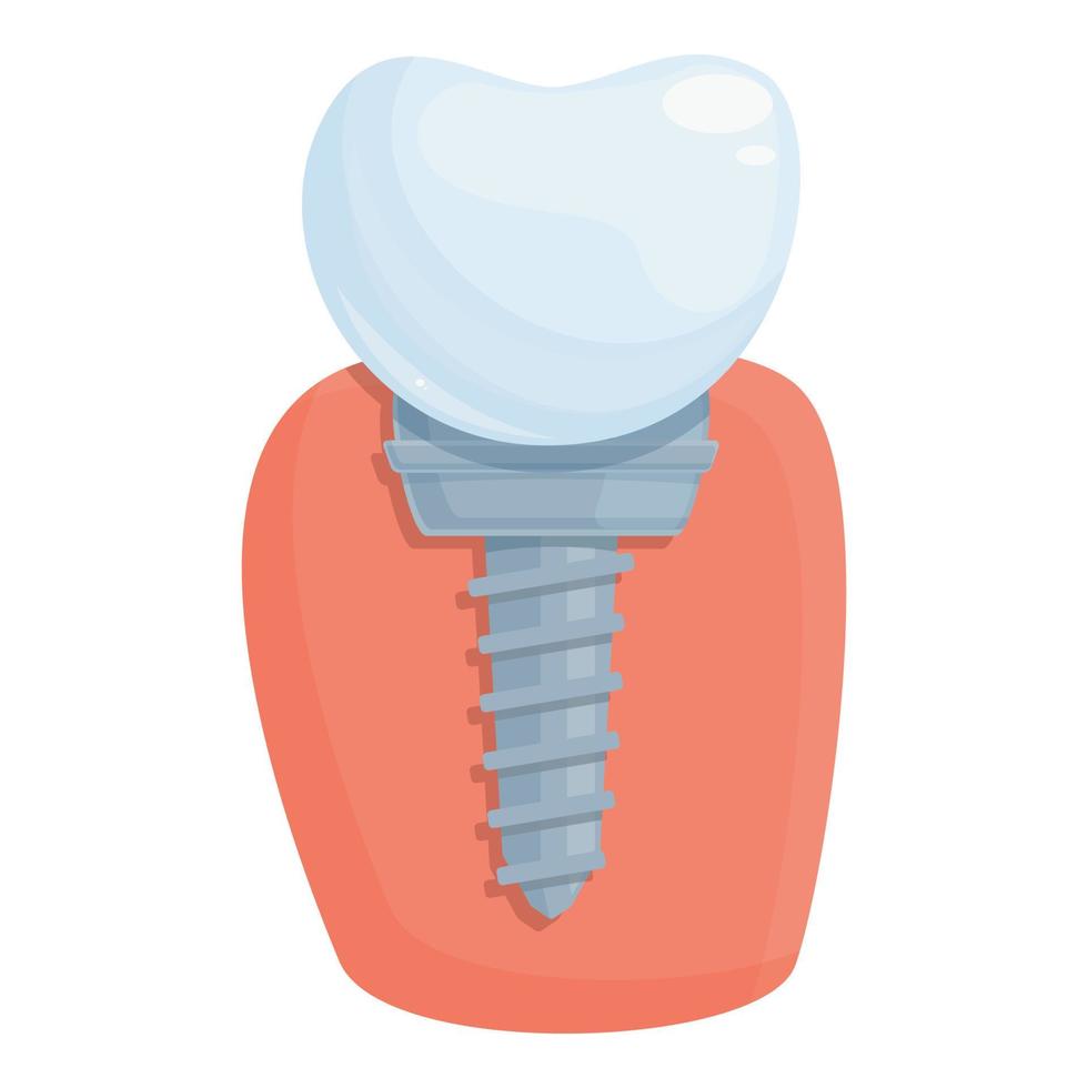 procedimiento vector de dibujos animados de icono de implante dental. corona dental