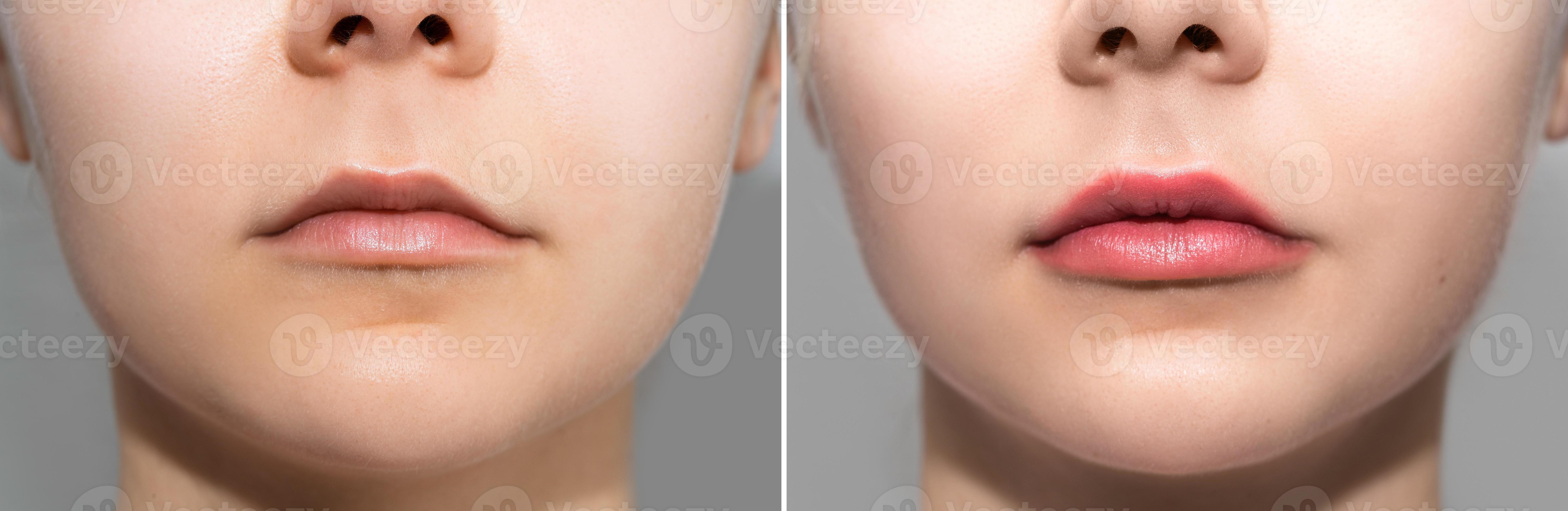 Female lips after permanent makeup lip blushing procedure 14346512 Stock Photo at Vecteezy