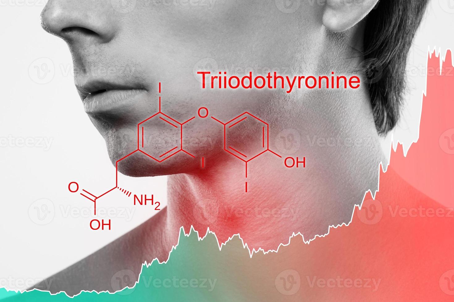 Male neck and chart of rising triiodothyronine hormone photo