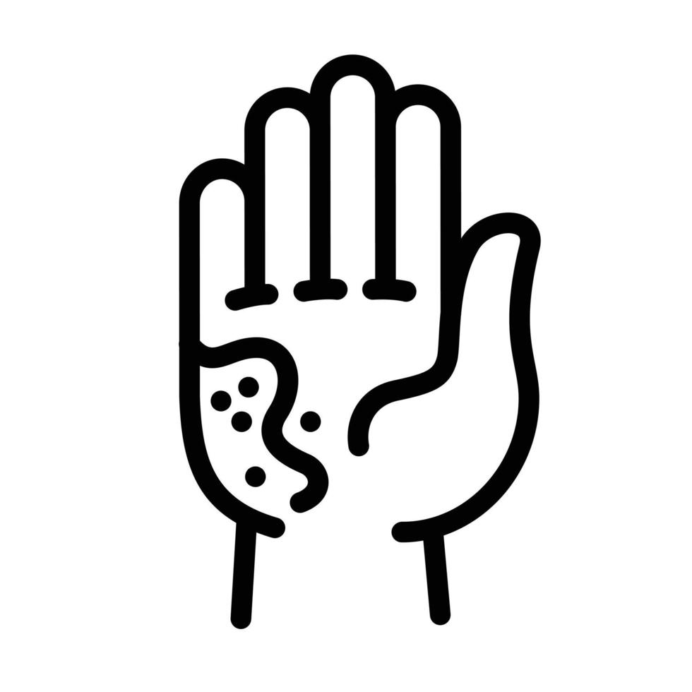 Kid hand frostbite icon, outline style vector