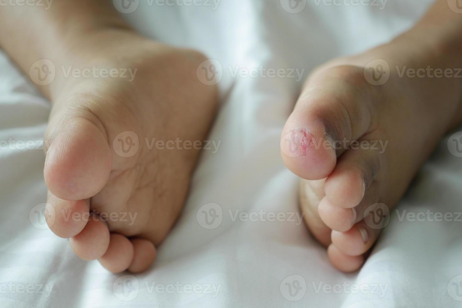 close up of dry child feet on bed , photo