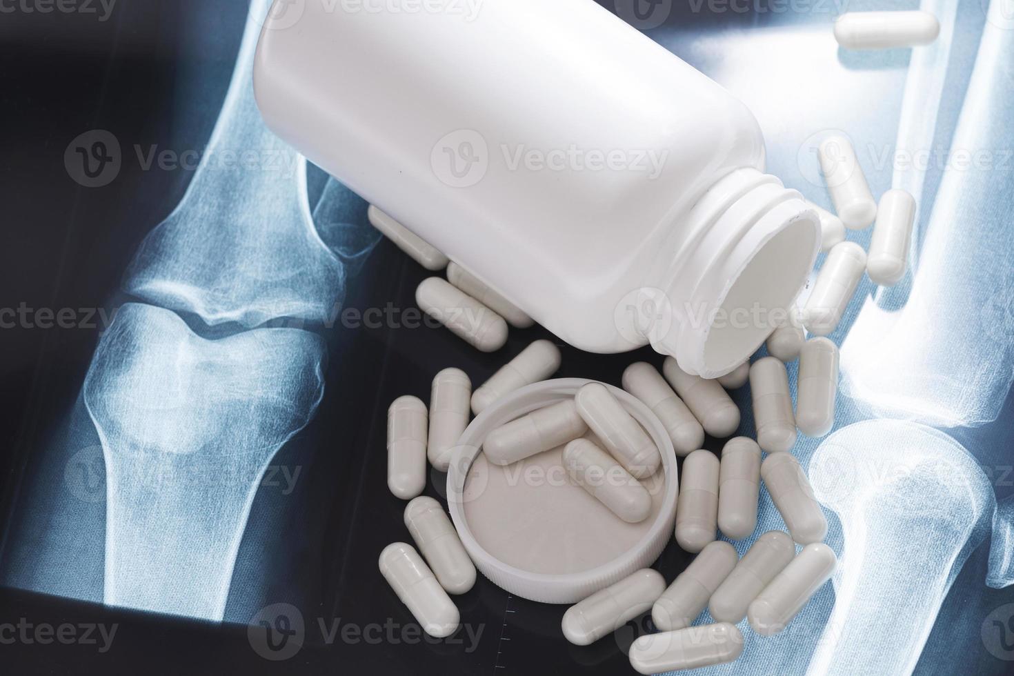 X-ray image and white capsules with dietary supplement or drug photo