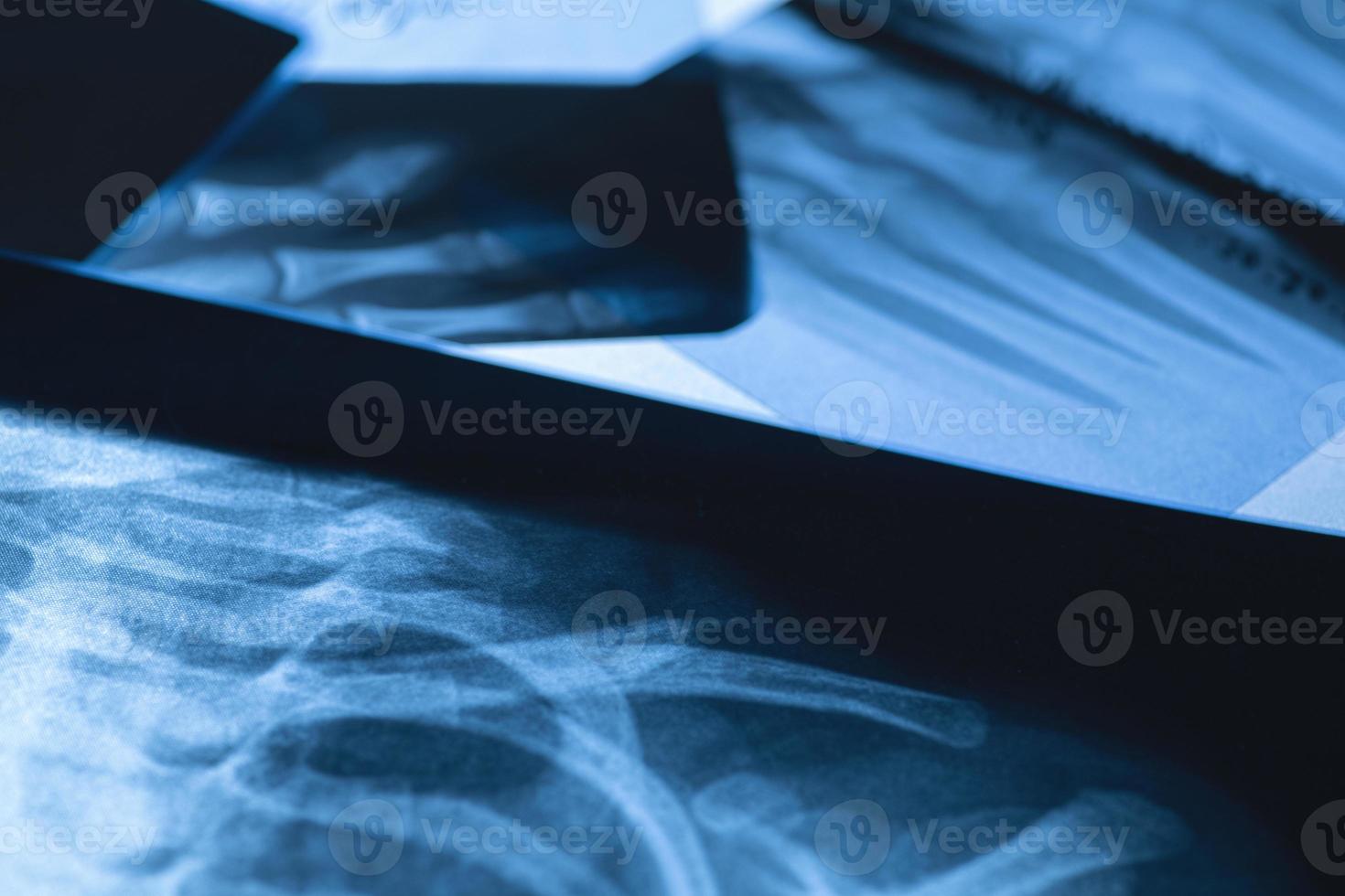 Closeup of different x-ray images photo
