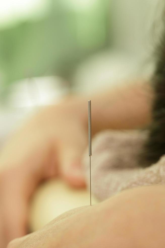 mano femenina con agujas de acero durante el procedimiento de terapia de acupuntura foto