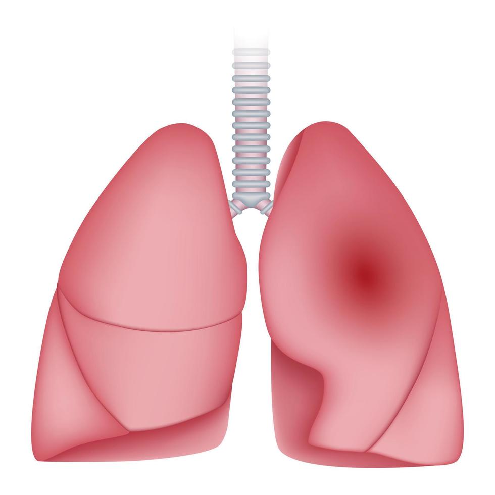 icono de los pulmones de la enfermedad de la neumonía, estilo realista vector