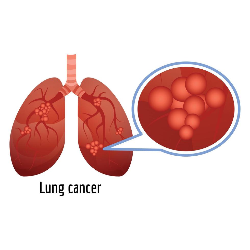 Lung cancer icon, cartoon style vector