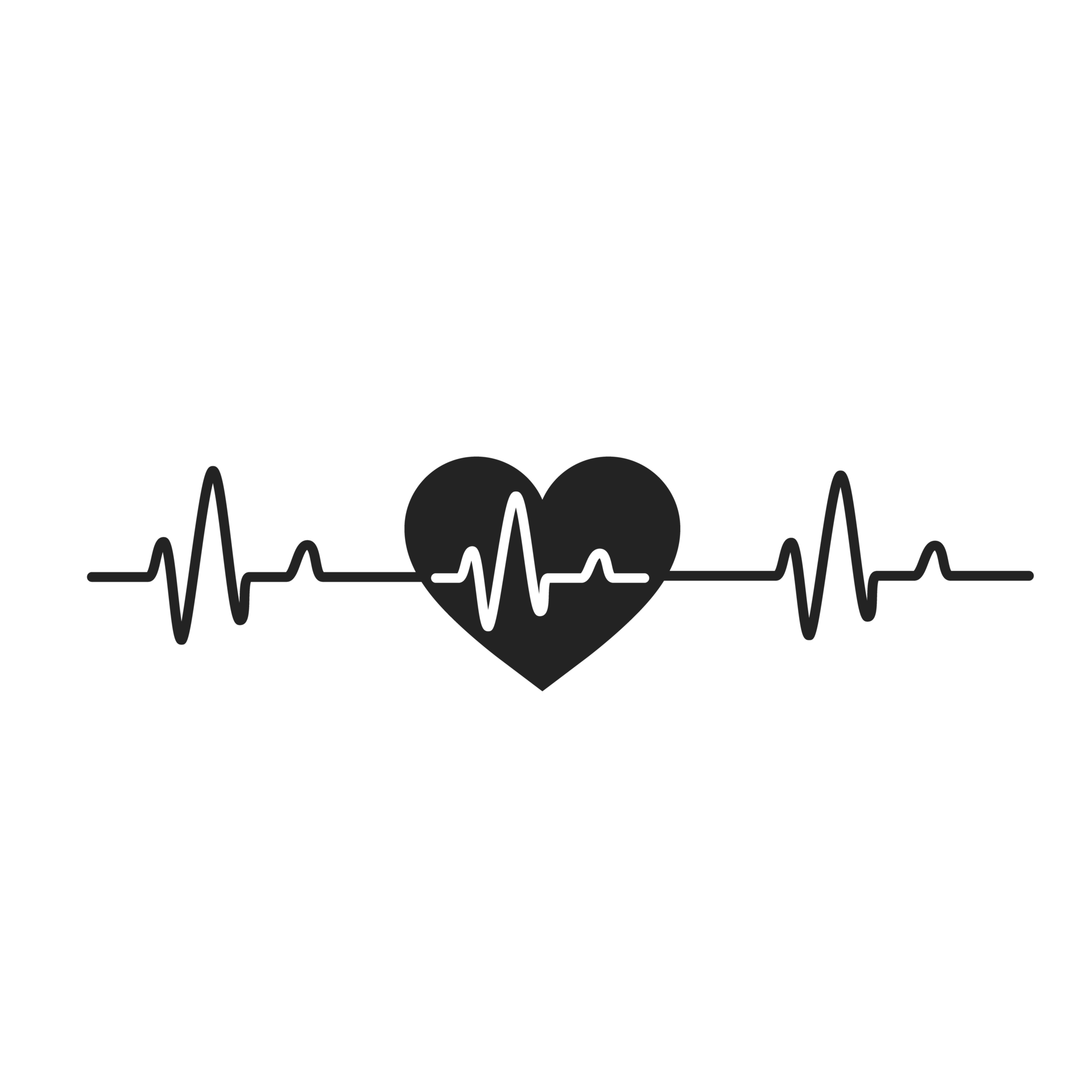Heartbeat Graphs of a fast heartbeat from caffeinated morning coffee