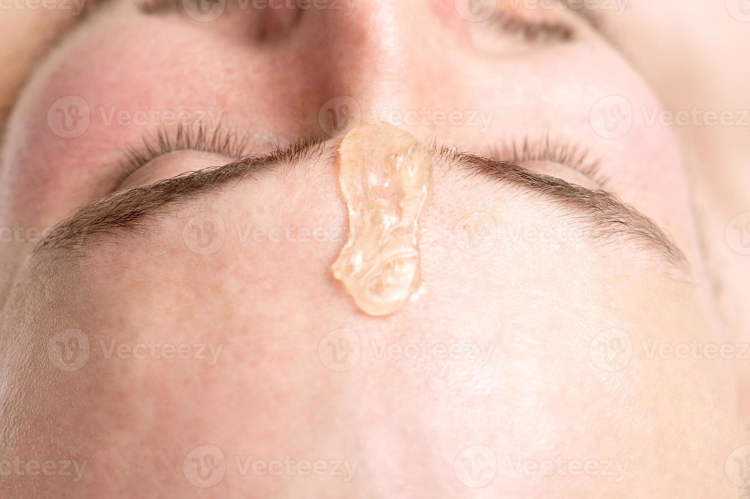 Liquid wax between the eyebrows of a young man photo