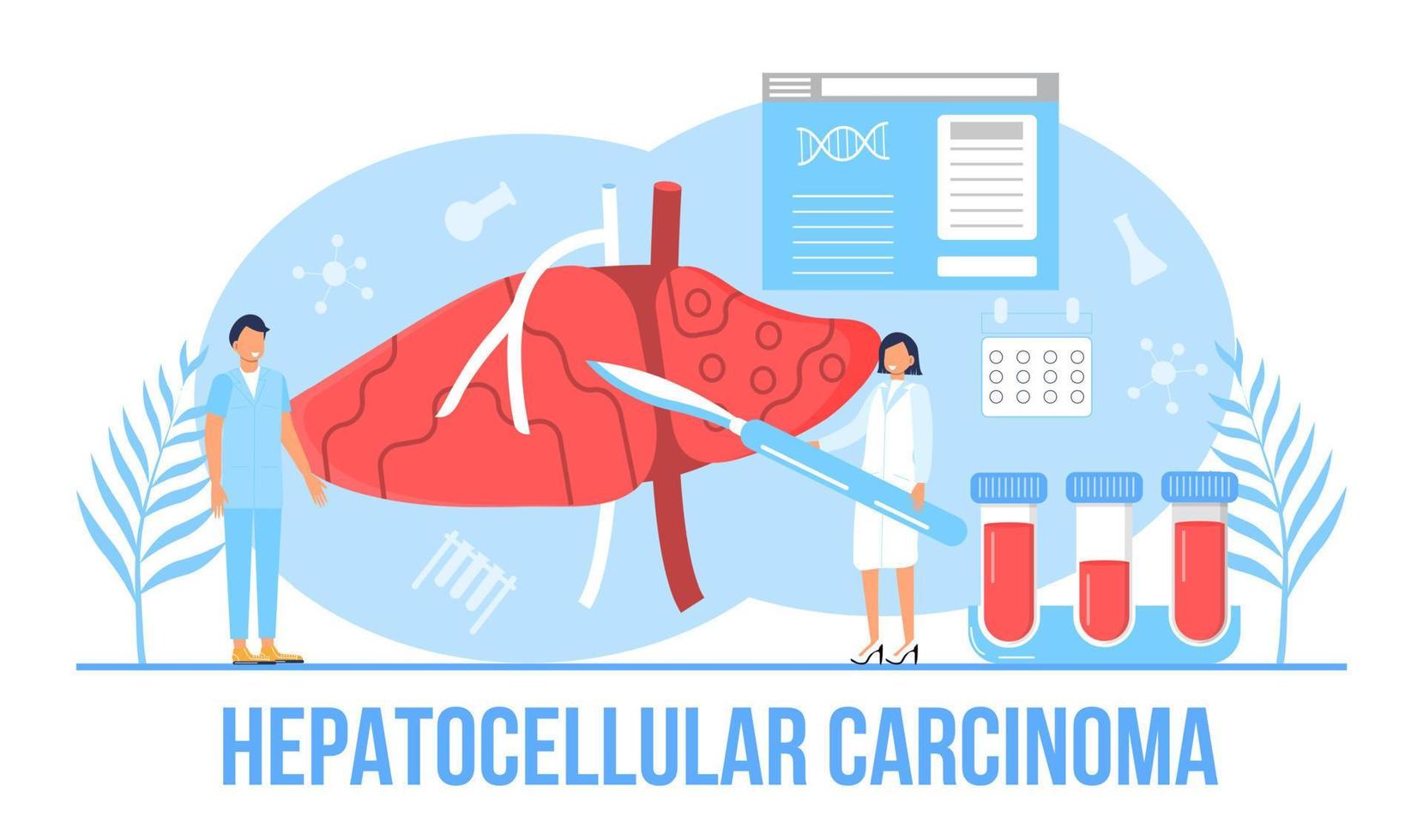 Hepatocellular carcinoma concept vector. Hepatitis A, B, C, D, cirrhosis, world hepatitis day. Tiny doctors treat liver vector