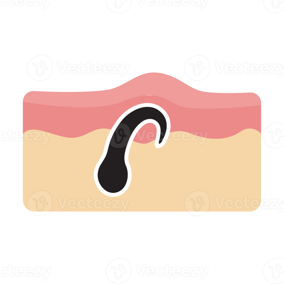 haar- icoon. haar- Aan menselijk huid haar- zorg concept oplossen de probleem van haar- verlies. png