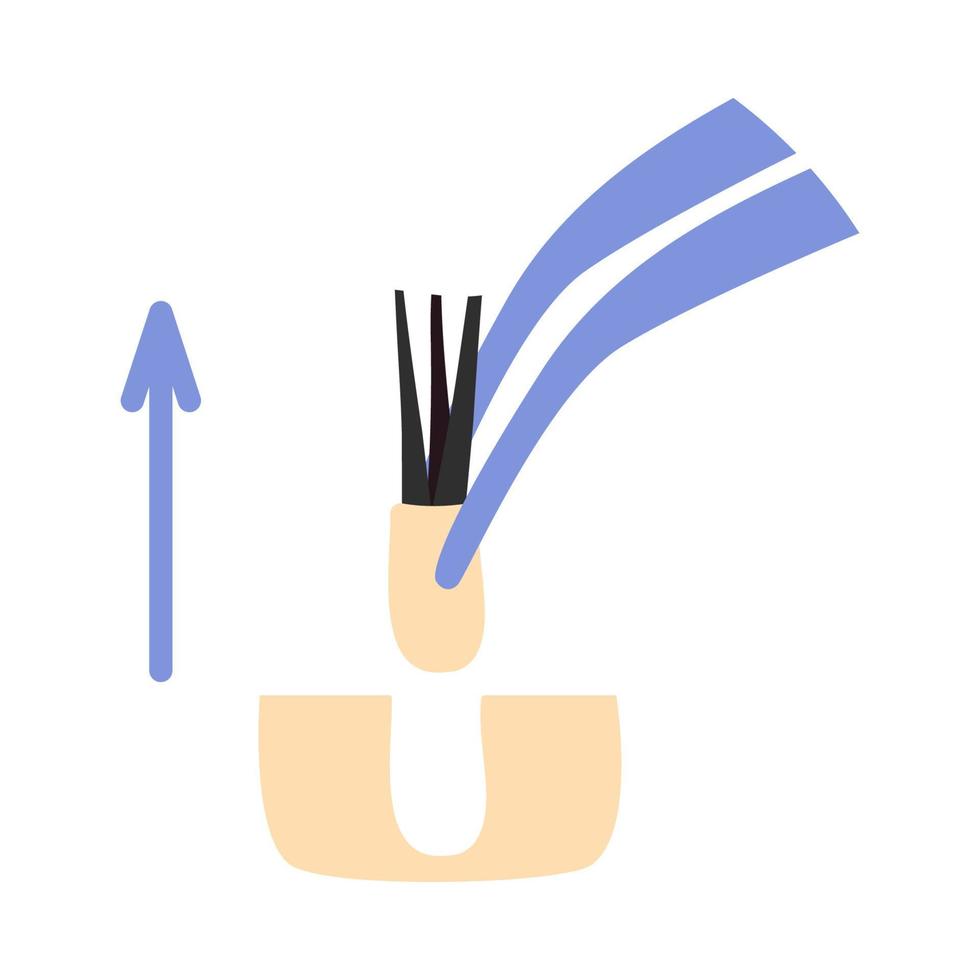 Hair transplant treatment forceps symbol. Surgical tweezers pulling out hair follicle. Alopecia medical procedure equipment tool. Hair loss diagnosis and transplantation concept. Vector illustration.