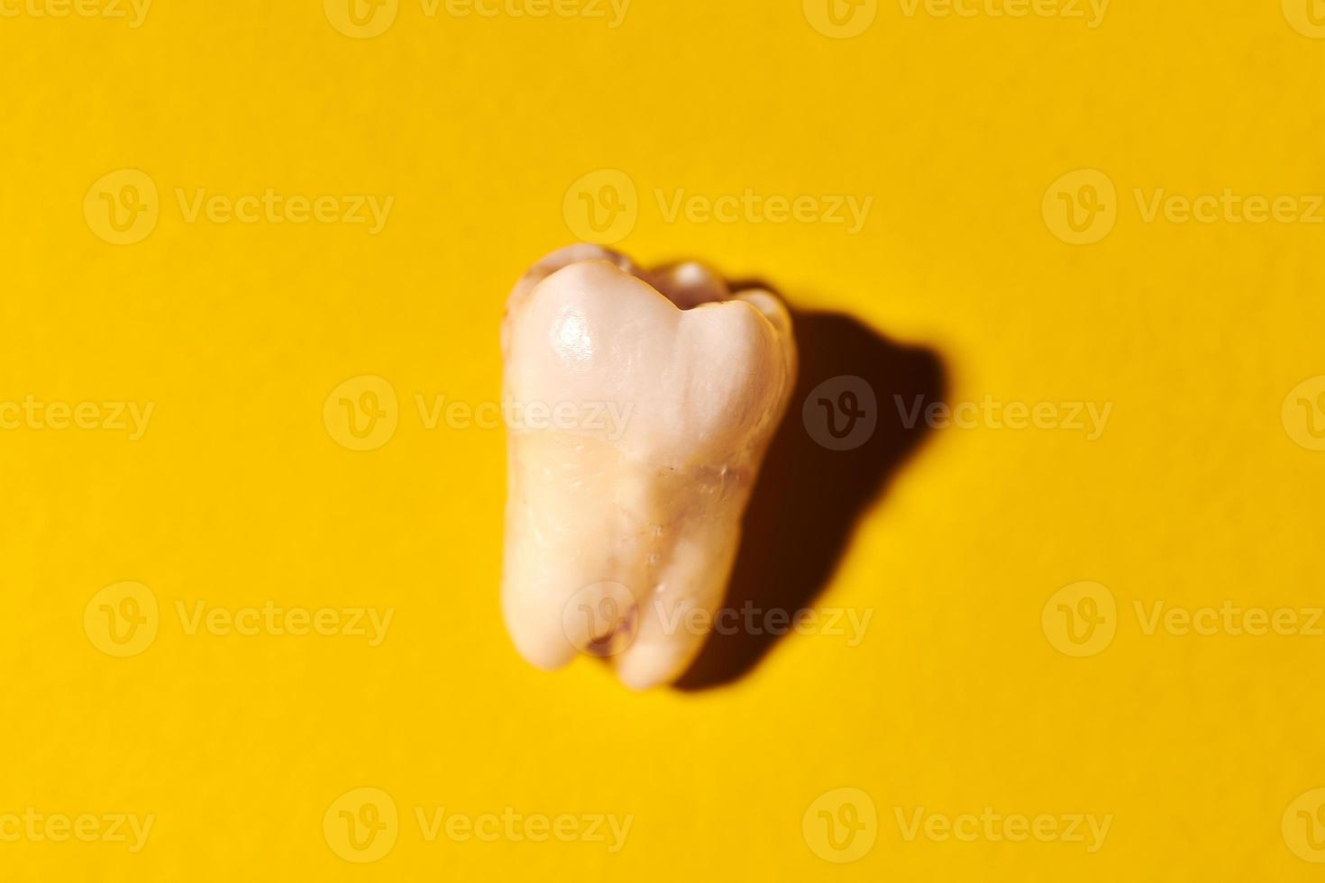 muela del juicio con caries, fondo amarillo foto