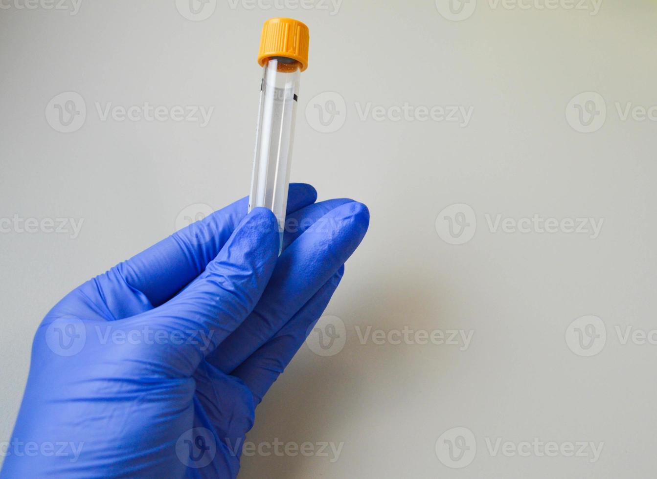 a test tube for venous blood in the hand of a doctor in a sterile glove. a doctor wearing a nitrile glove draws blood from a vein. accurate laboratory diagnostics photo