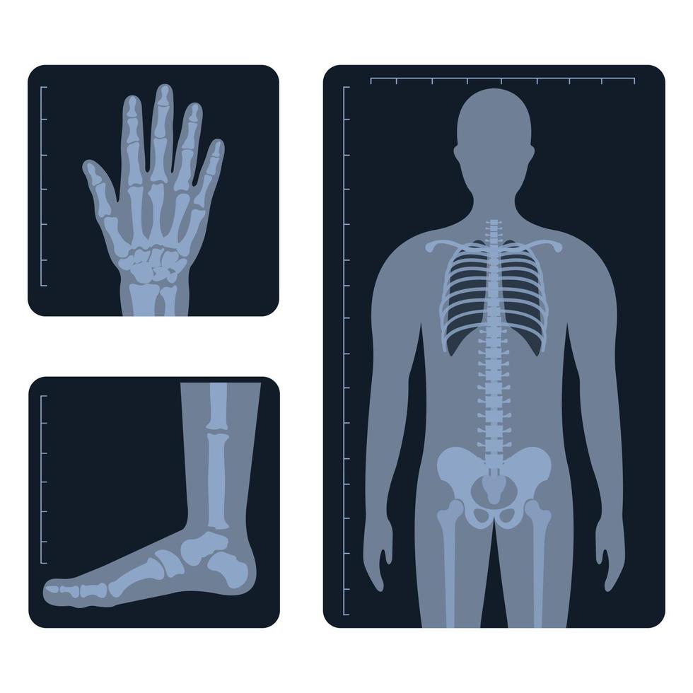 Medical radiology. Different x-ray or radiographic images of human body bones and parts vector