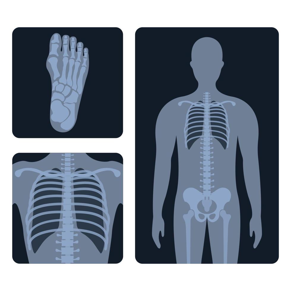 radiología médica. diferentes imágenes radiográficas o de rayos X de huesos y partes del cuerpo humano vector