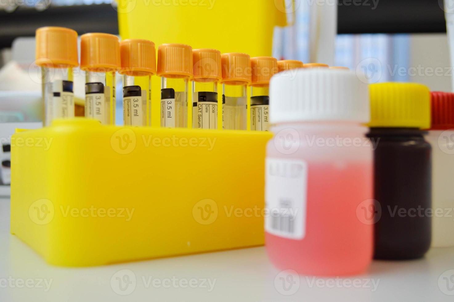 tubes in the holder next to liquid reagents for performing research. laboratory tests to detect diseases. venous blood tests under sterile conditions photo