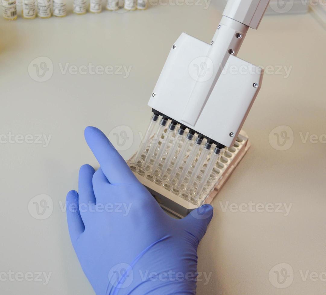 performing laboratory analysis by enzyme immunoassay. a blood test from a vein. portable pipette for handling liquids. liquid media processing system. laboratory diagnostics photo