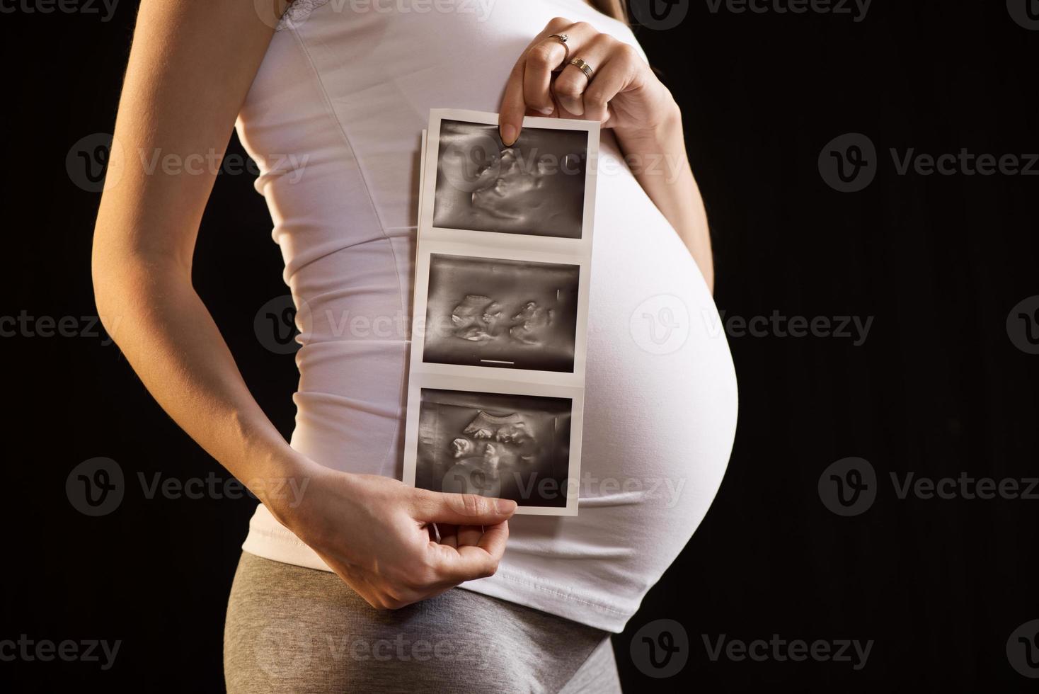 Ultrasound pregnancy view photo