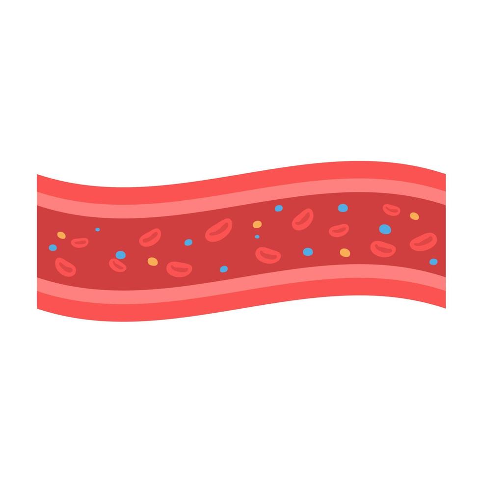 coronary arteries with accumulated fat in the body vector