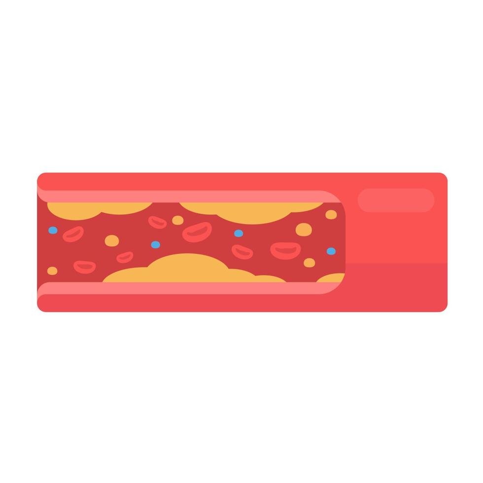 coronary arteries with accumulated fat in the body vector