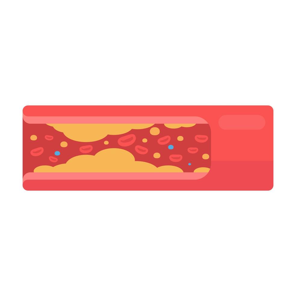 coronary arteries with accumulated fat in the body vector