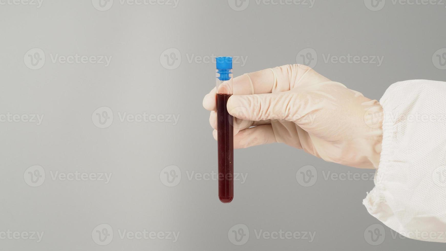 The hand is holding a blood test tube on grey background. Hand wears a PPE suit and a white medical glove. photo