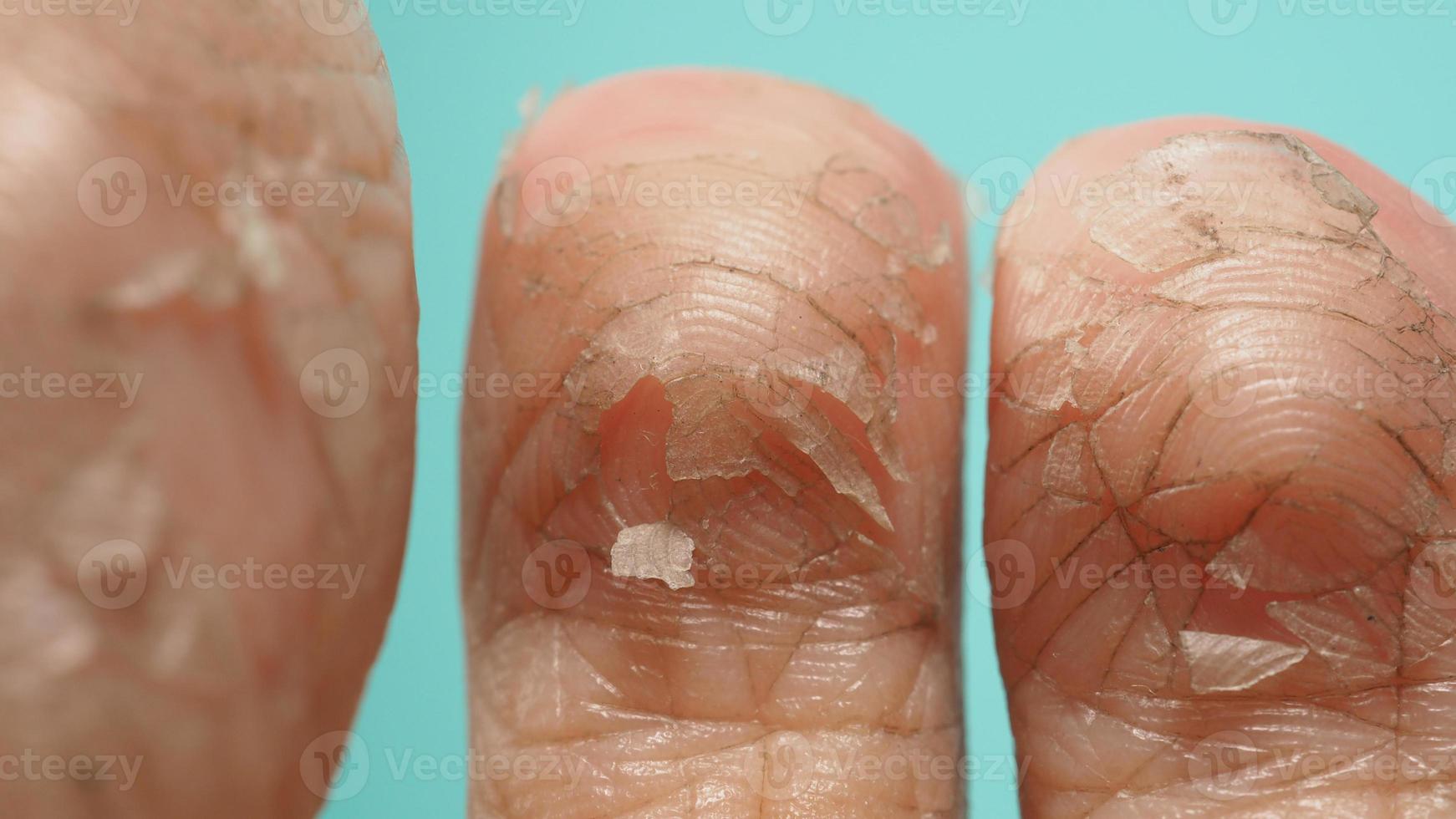 Close up of Foot peeling or remove dead skin on green or tiffany blue background. photo