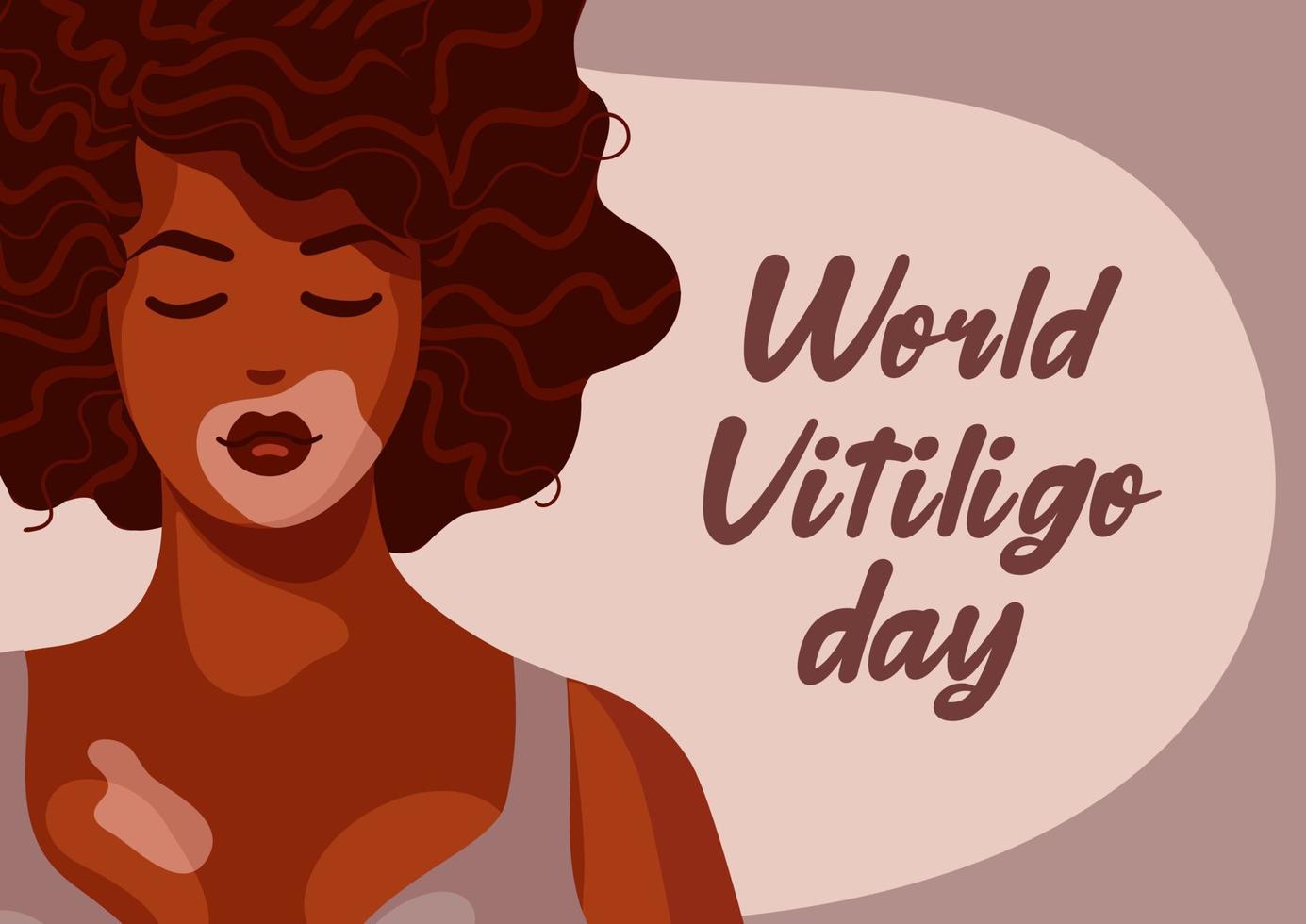 Beautiful African American woman, vitiligo on dark skin and wavy curly hair. Body positive concept vector illustration. World vitiligo day. Skin depigmentation disease. For posters, postcards, banners