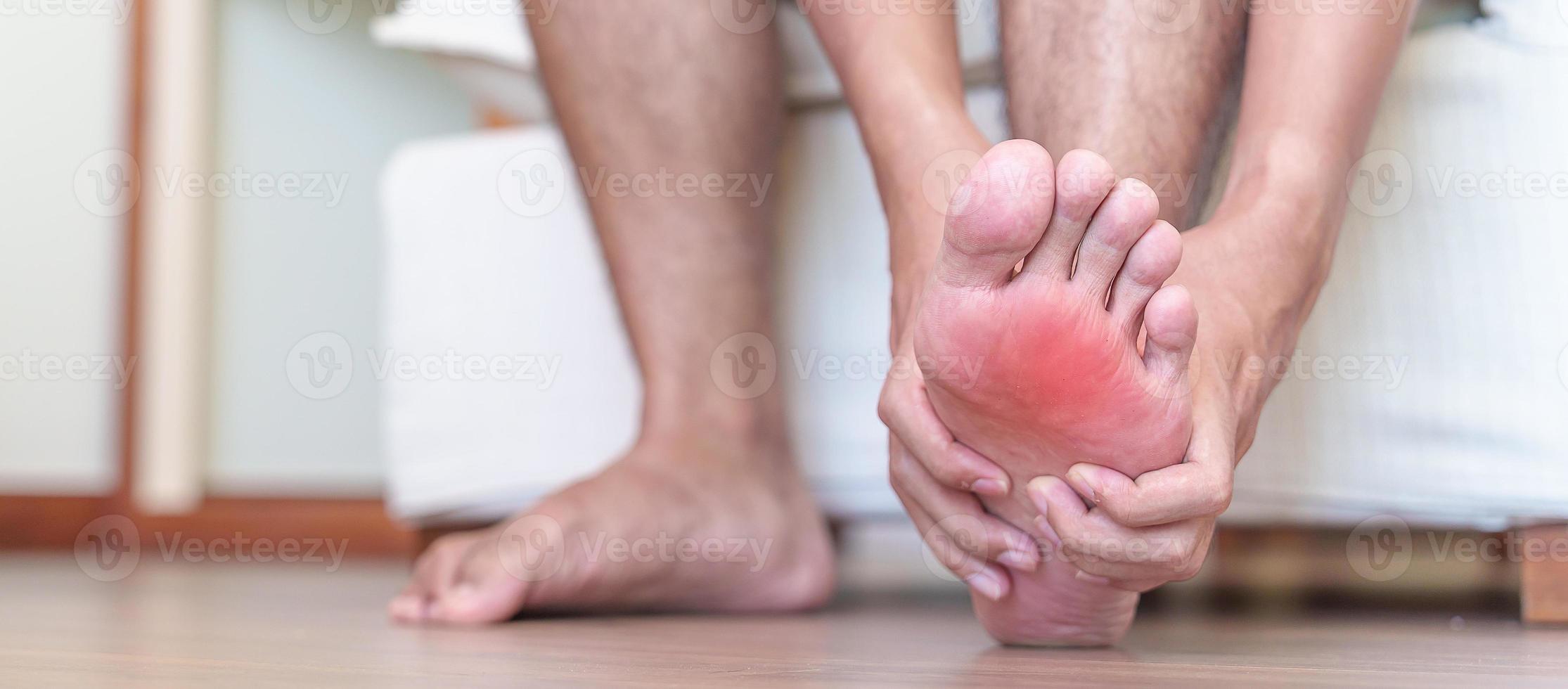 man having barefoot pain due to Plantar fasciitis and  bunion toes or blister due to wearing narrow shoes and waking or running longtime. Health and medical concept photo