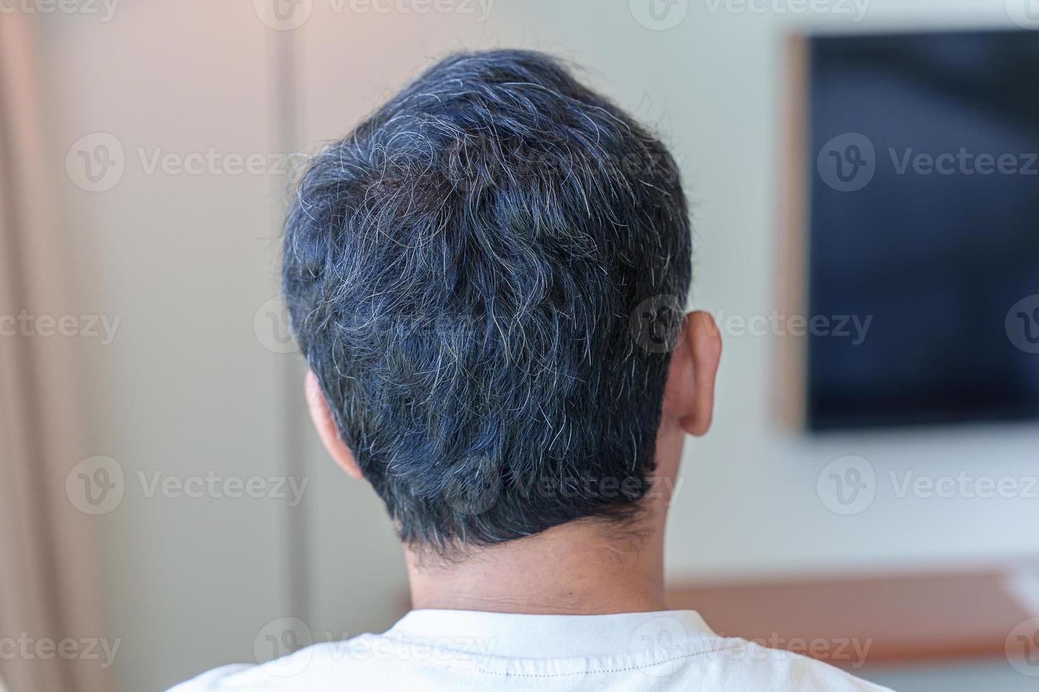 asian man having grey and white hair growing up. Hair problem concept