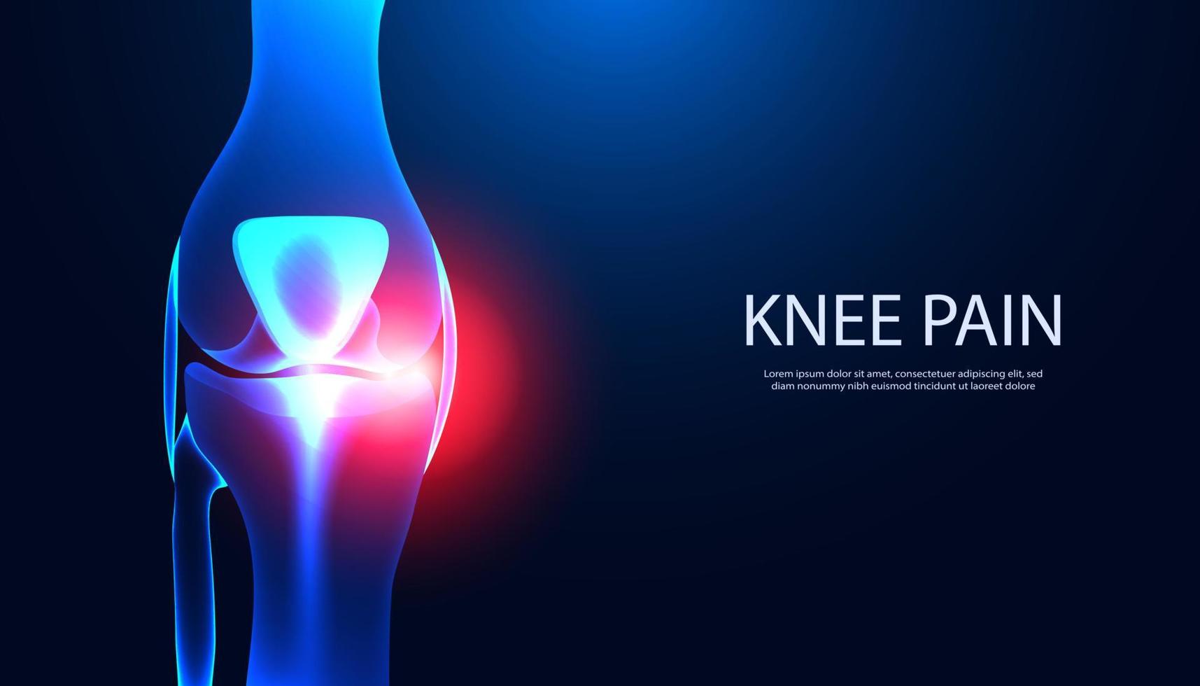 Abstract Bone, Knee part Anatomy X-ray model showing knee injury with red light. For inserting text, articles or templates vector