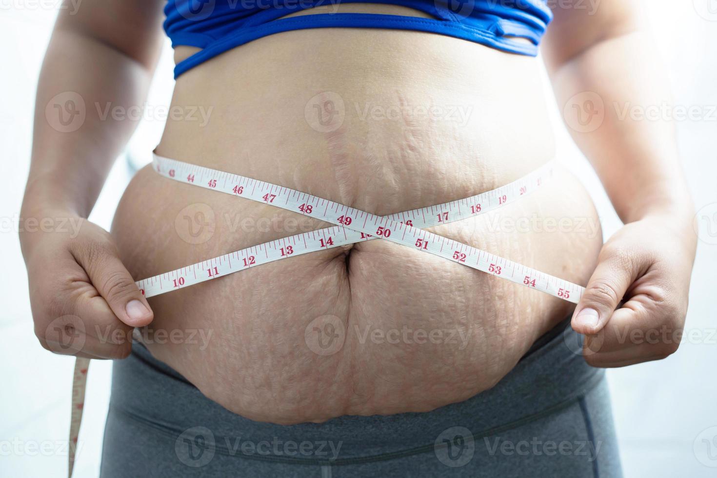 mujer obesa necesita control de peso, tiene exceso de grasa. foto