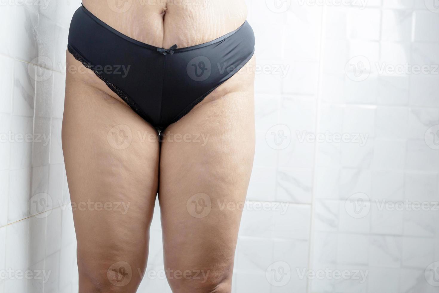 Obese woman needs weight control, she has excess fat. photo