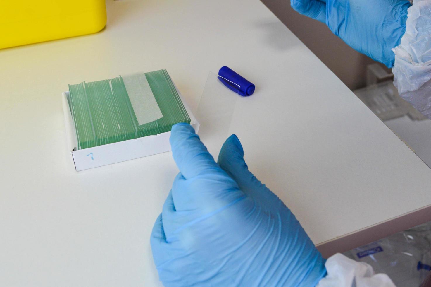 nurse works with biological material. disposable glasses for the material are numbered and signed. PCR research, microbiology. examining material under a microscope photo